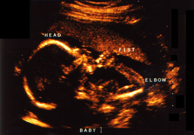 Baby Heartbeat Girl on Now Playing Matisyahu Beat Box