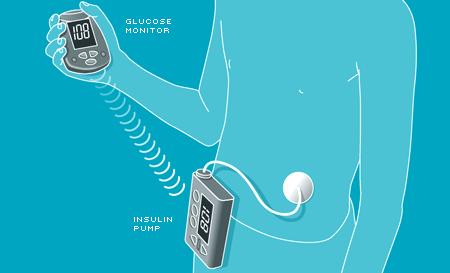 Medtronic Minimed 508 Insulin