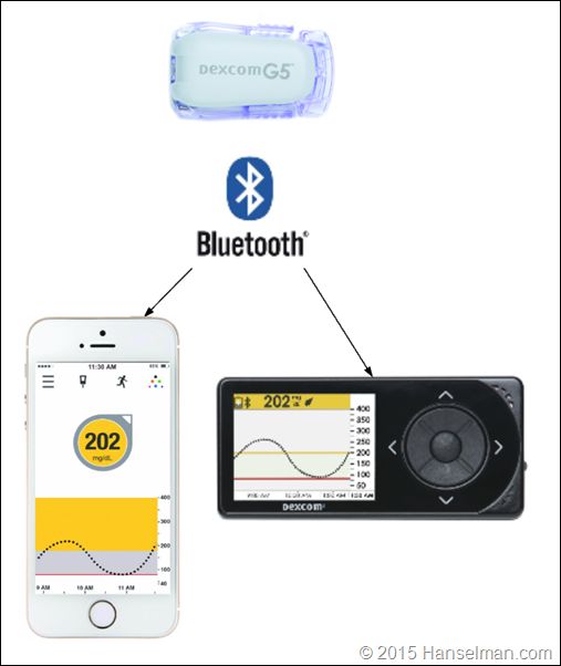 Diabetes Technology: Dexcom G5 CGM Review - So much wasted potential