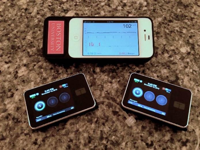 It's two pumps, one with insulin, one with glucagon, and an iPhone controlling them both It's two pumps, one with insulin, one with glucagon, and an iPhone controlling them both