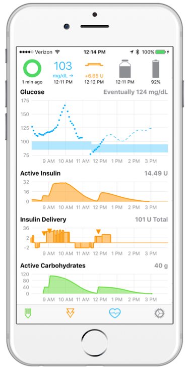 Open Source Artificial Pancreas on iPhone